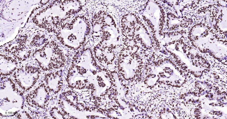 白细胞介素增强子结合因子3重组兔单抗