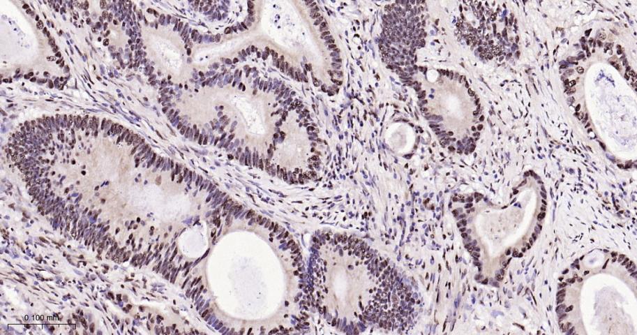 磷酸化p38 MAPK重组兔单抗