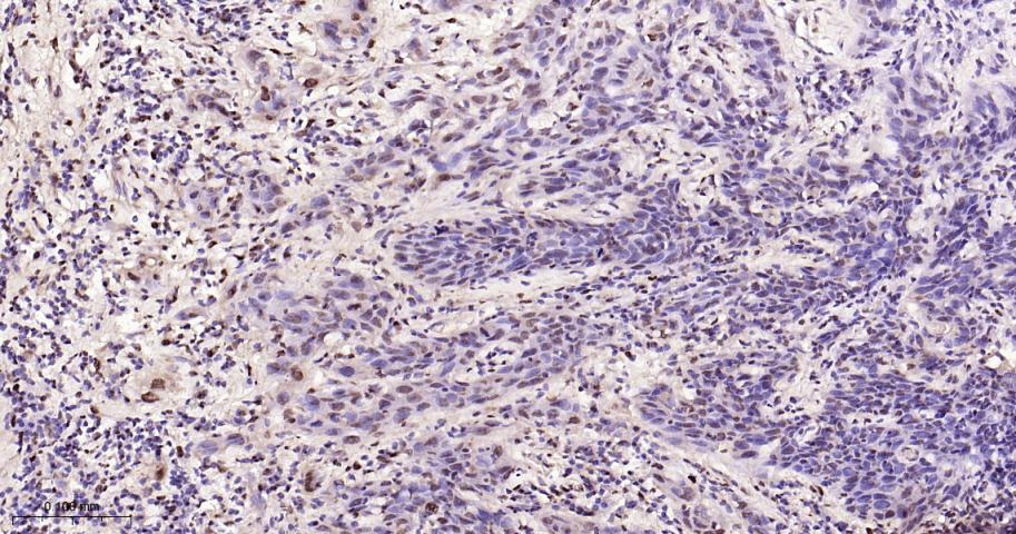 磷酸化p38 MAPK重组兔单抗