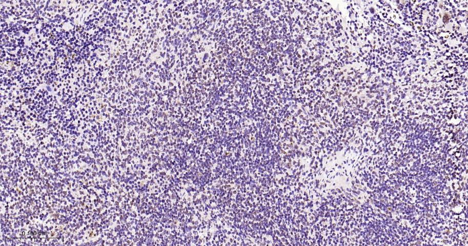 磷酸化p38 MAPK重组兔单抗