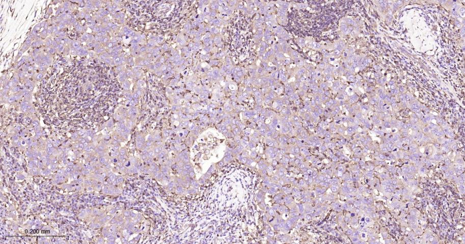 β-肌动蛋白/β-Actin（内参）重组兔单抗