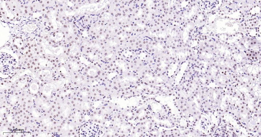 拓普西异构酶Ⅰ重组兔单抗