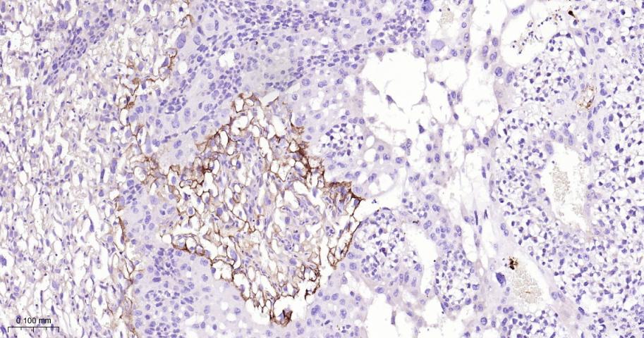 角膜上皮蛋白TGFBI重组兔单抗