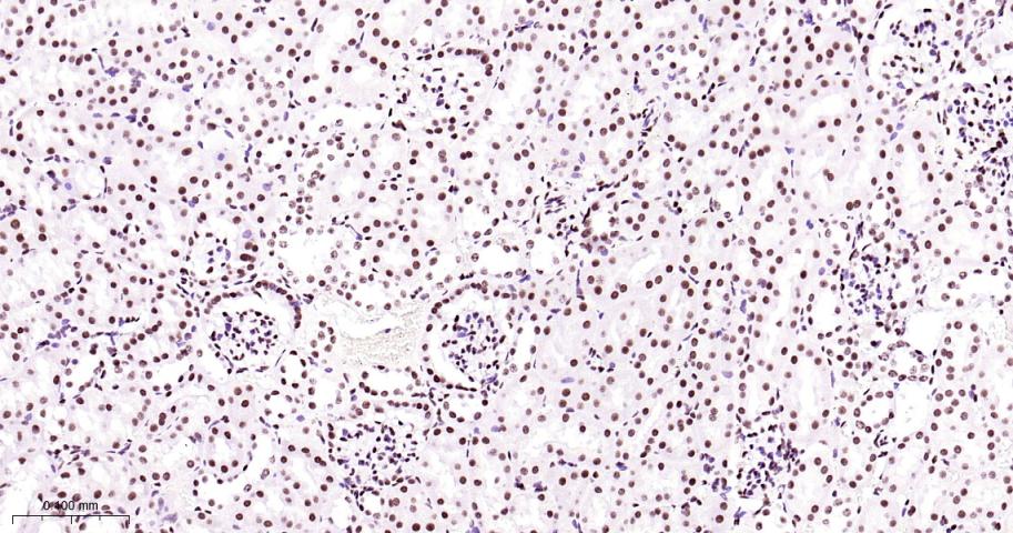 白细胞介素增强子结合因子3重组兔单抗