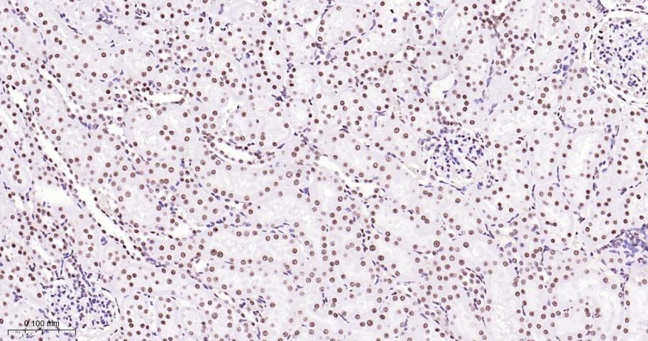 拓普西异构酶Ⅰ重组兔单抗