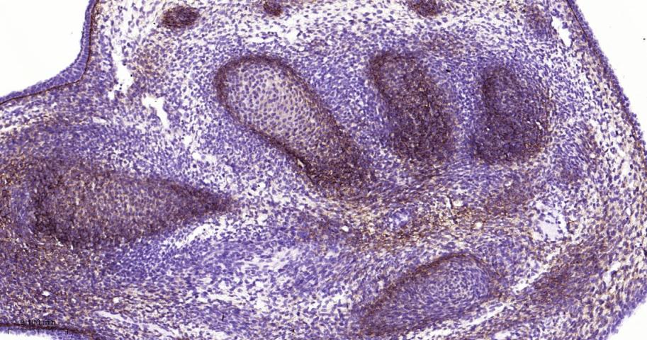 角膜上皮蛋白TGFBI重组兔单抗