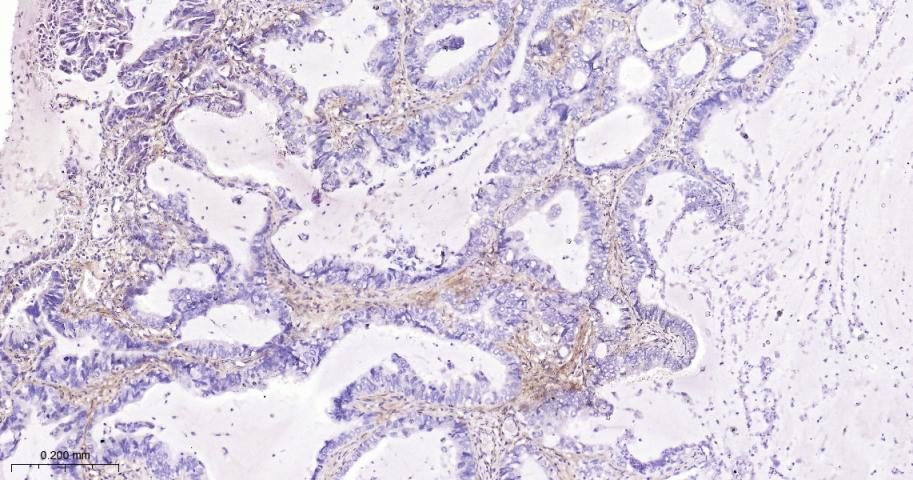 角膜上皮蛋白TGFBI重组兔单抗