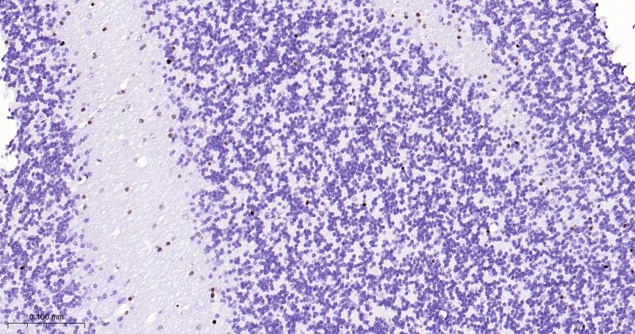 少突胶质细胞转录因子2重组兔单抗