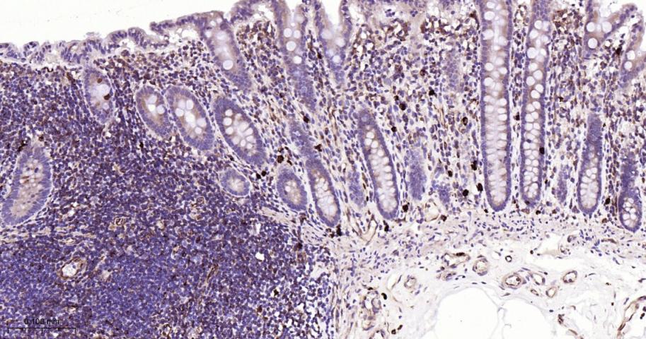 跨膜蛋白173重组兔单抗