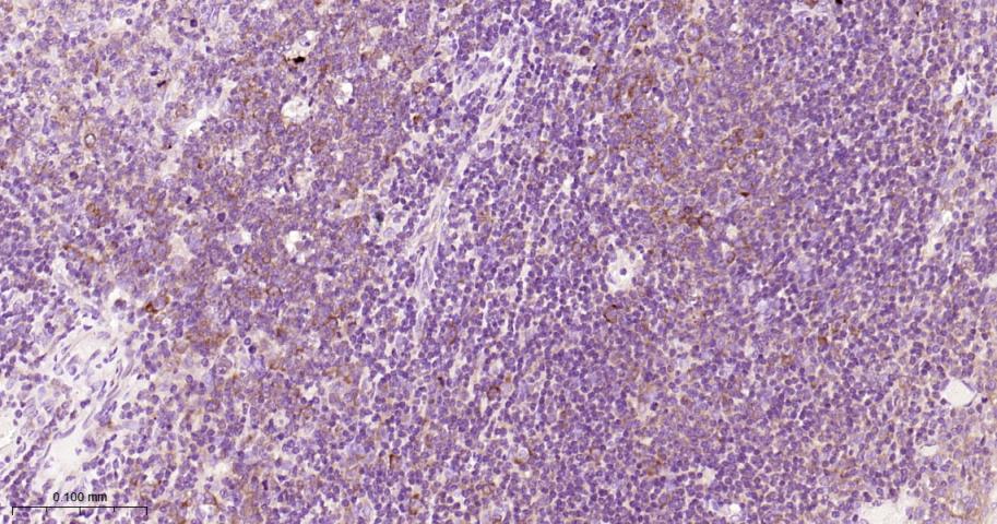 肿瘤坏死因子受体2重组兔单抗