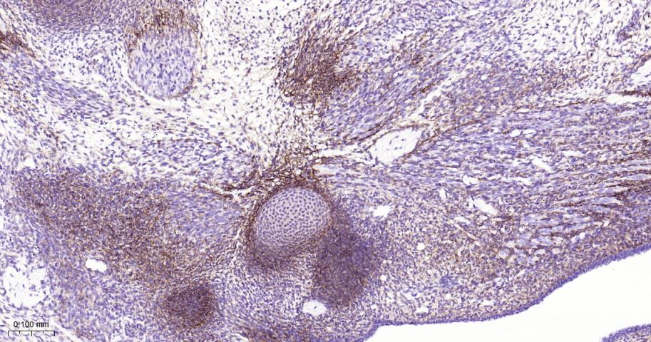 角膜上皮蛋白TGFBI重组兔单抗