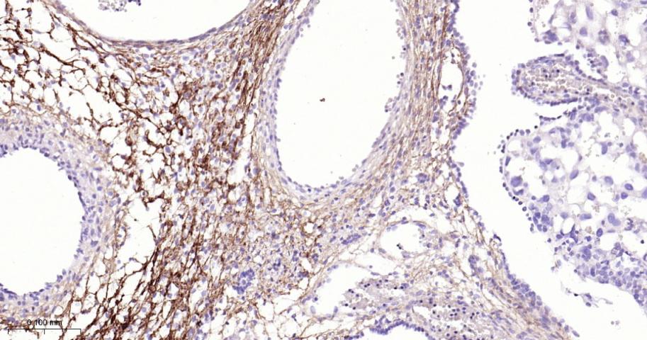 角膜上皮蛋白TGFBI重组兔单抗
