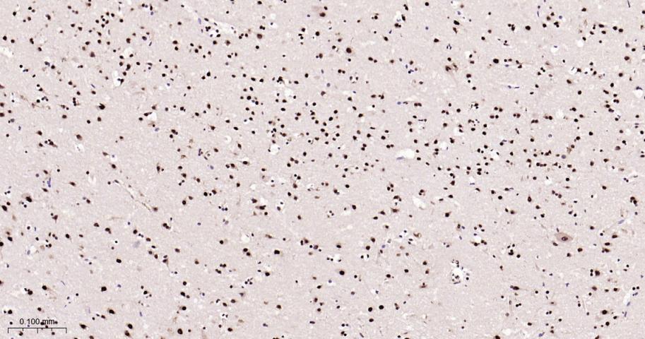 磷酸化p38 MAPK重组兔单抗