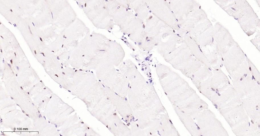 叉头蛋白P1重组兔单抗
