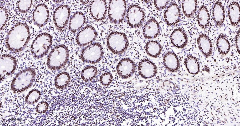 白细胞介素增强子结合因子3重组兔单抗