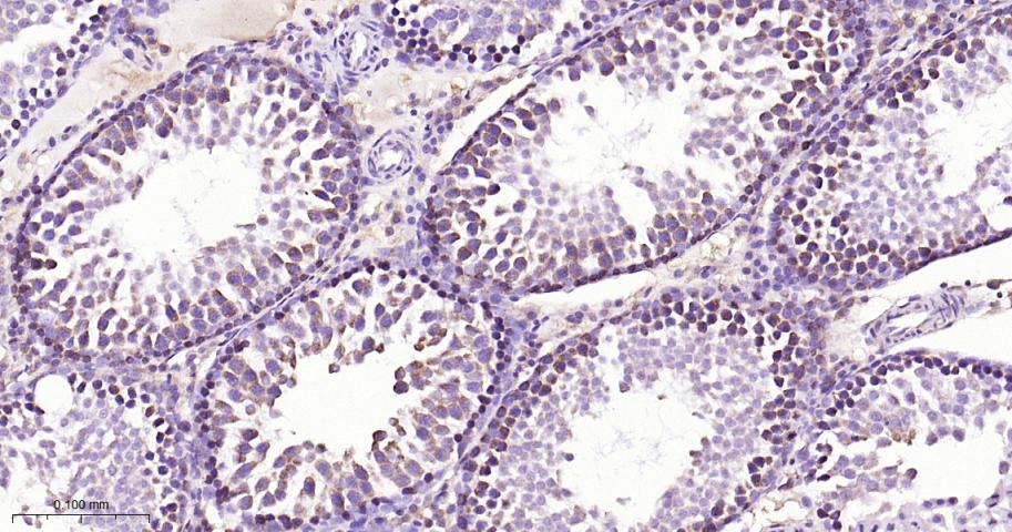 核糖核酸酶L抑制蛋白重组兔单抗