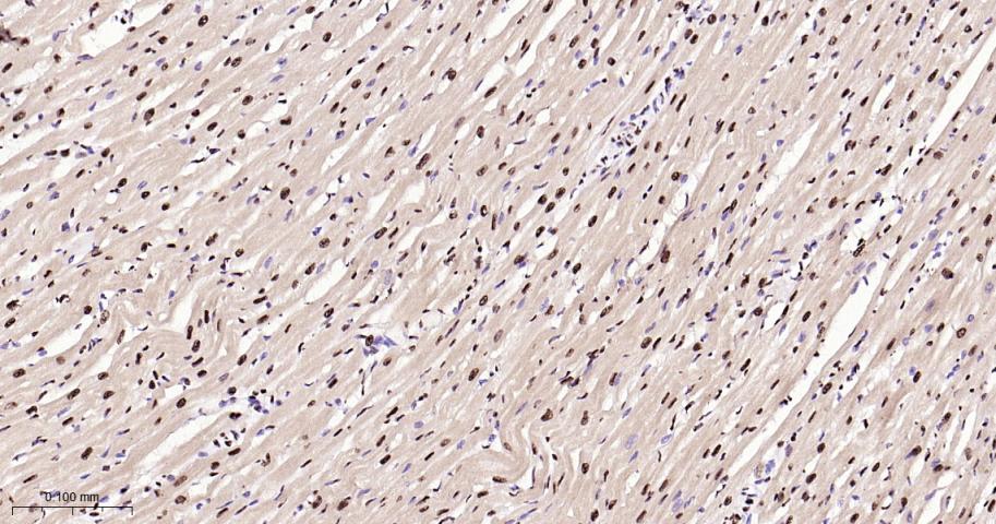 磷酸化p38 MAPK重组兔单抗