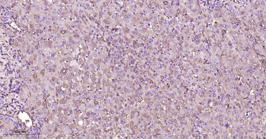 载脂蛋白A1重组兔单抗