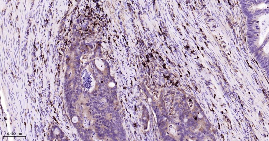 跨膜蛋白173重组兔单抗