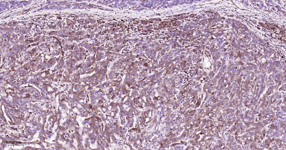 跨膜蛋白173重组兔单抗