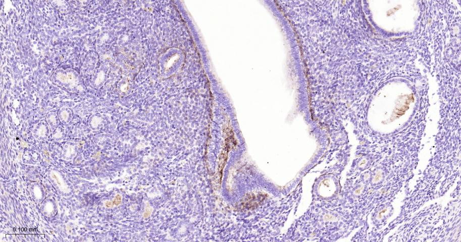 角膜上皮蛋白TGFBI重组兔单抗