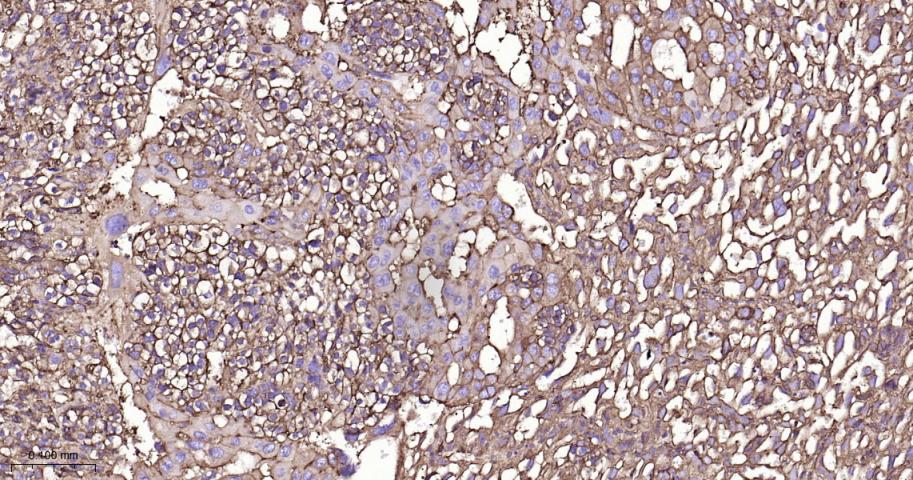 β-肌动蛋白/β-Actin（内参）重组兔单抗
