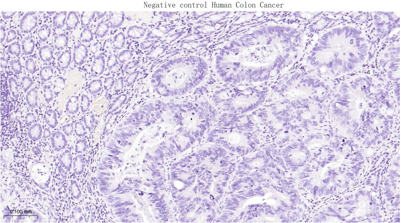 少突胶质细胞转录因子2重组兔单抗