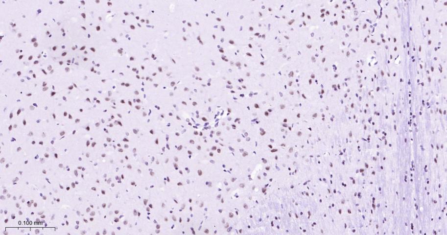 拓普西异构酶Ⅰ重组兔单抗