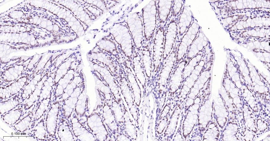 拓普西异构酶Ⅰ重组兔单抗
