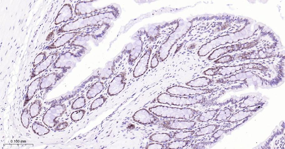 拓普西异构酶Ⅰ重组兔单抗