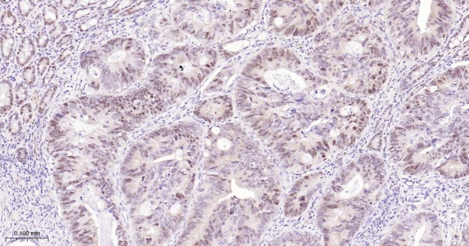 叉头蛋白P1重组兔单抗