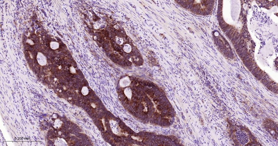 肿瘤坏死因子受体2重组兔单抗