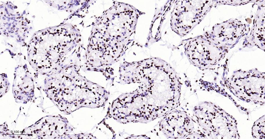 白细胞介素增强子结合因子3重组兔单抗