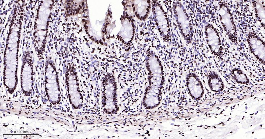 白细胞介素增强子结合因子3重组兔单抗
