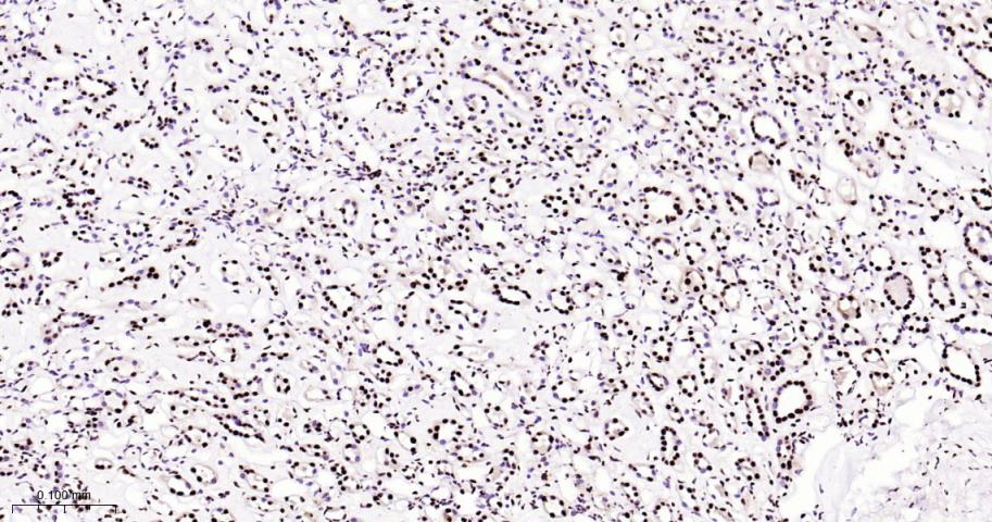 白细胞介素增强子结合因子3重组兔单抗