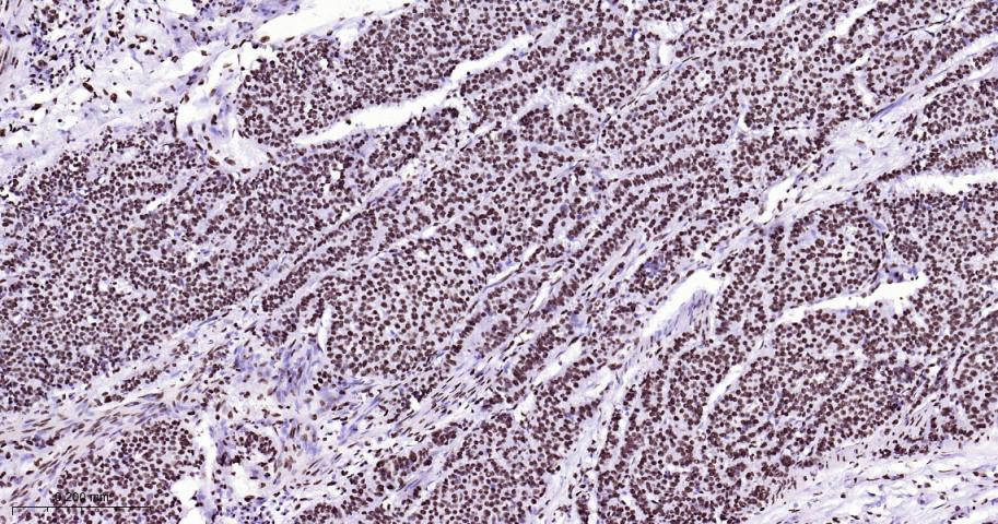 白细胞介素增强子结合因子3重组兔单抗