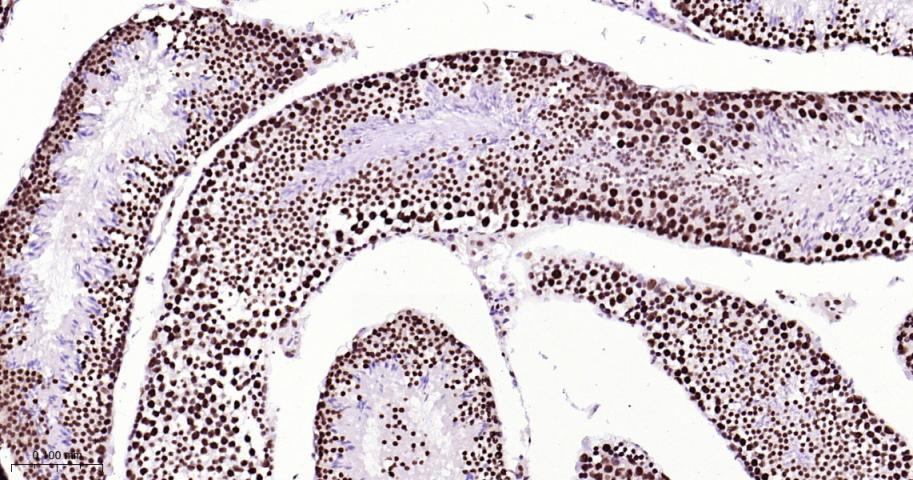 白细胞介素增强子结合因子3重组兔单抗