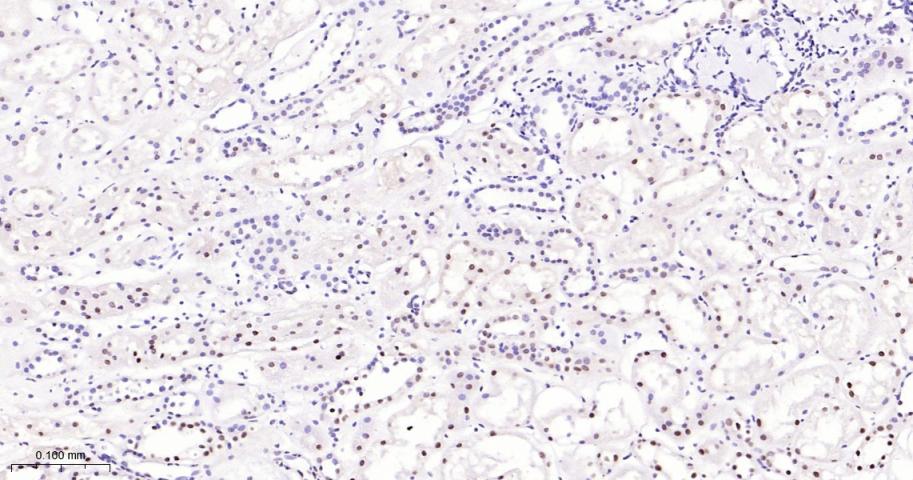 拓普西异构酶Ⅰ重组兔单抗