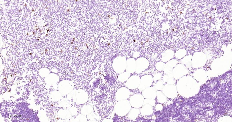 CD134重组兔单抗