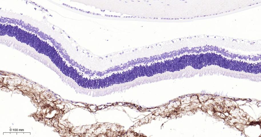 角膜上皮蛋白TGFBI重组兔单抗