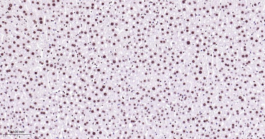 白细胞介素增强子结合因子3重组兔单抗