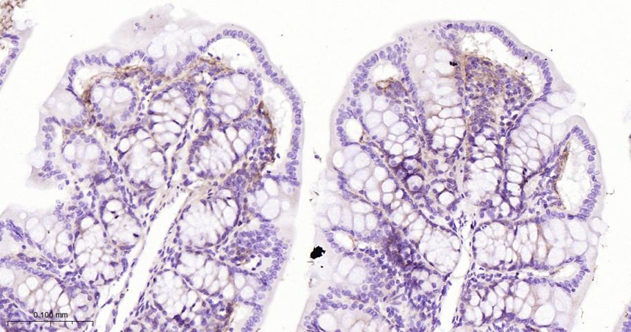 角膜上皮蛋白TGFBI重组兔单抗