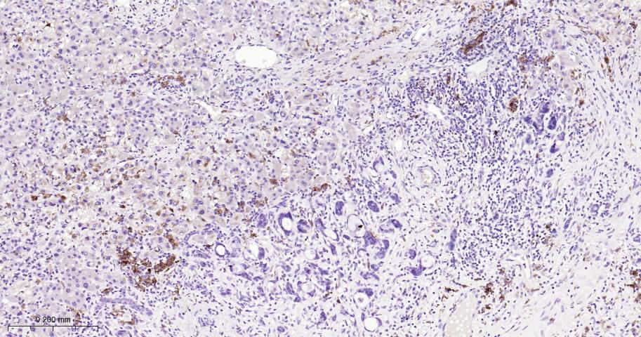 抗酒石酸酸性磷酸酶5型/5型酸性磷酸酶重组兔单抗