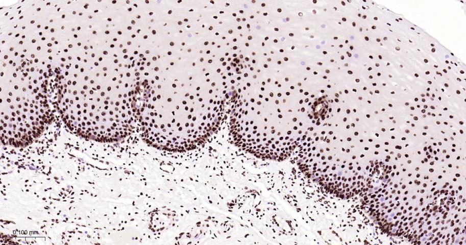 白细胞介素增强子结合因子3重组兔单抗