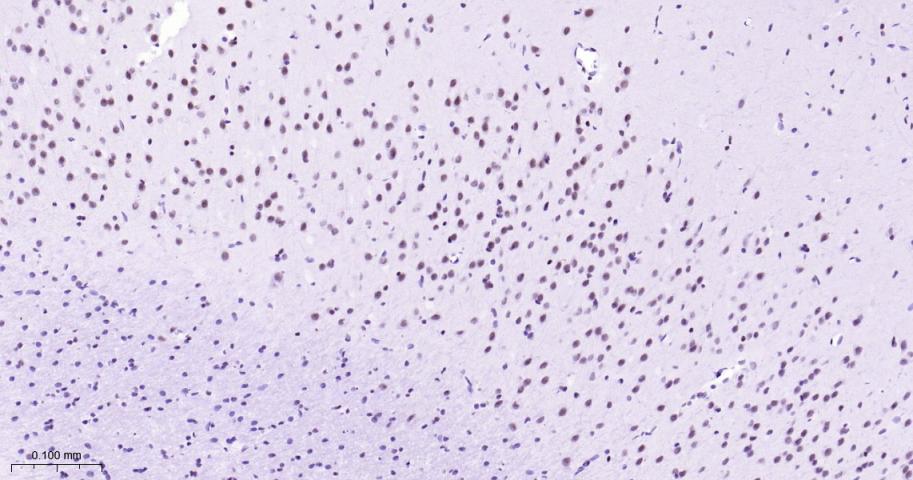 拓普西异构酶Ⅰ重组兔单抗