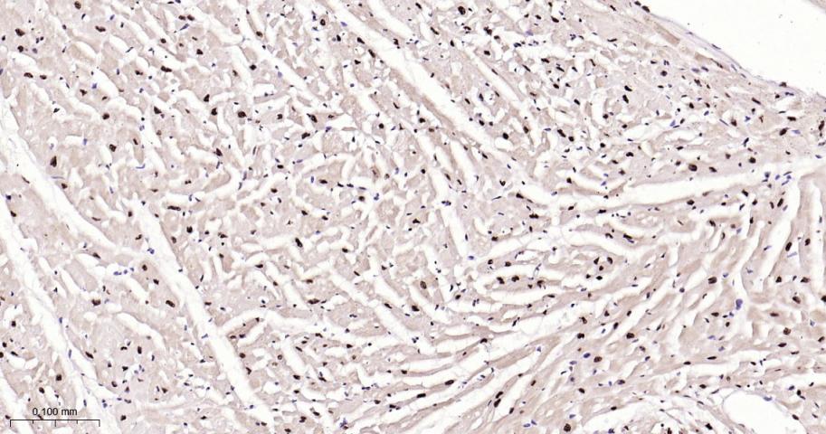 磷酸化p38 MAPK重组兔单抗