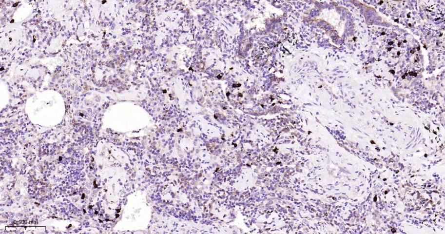 跨膜蛋白173重组兔单抗