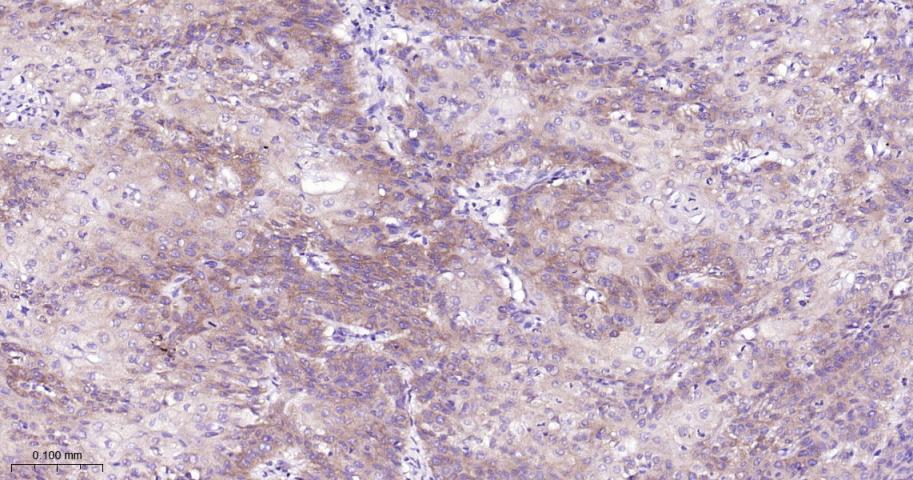 肿瘤坏死因子受体2重组兔单抗