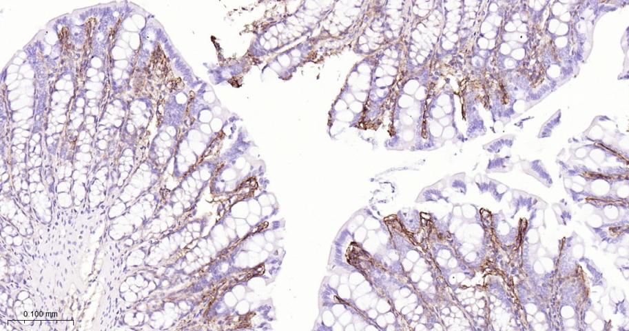 角膜上皮蛋白TGFBI重组兔单抗