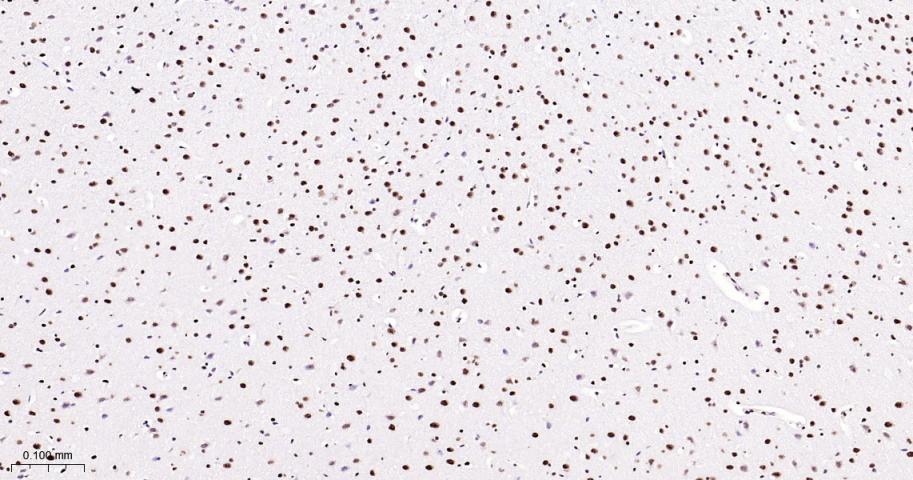 磷酸化p38 MAPK重组兔单抗